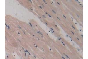 Detection of GP9 in Rat Heart Tissue using Polyclonal Antibody to Glycoprotein IX, Platelet (GP9) (CD42a 抗体  (AA 1-189))
