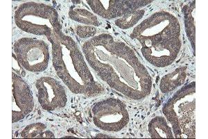 Image no. 8 for anti-PHD Finger Protein 7 (PHF7) (AA 155-381) antibody (ABIN1490975)