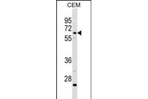 C8B Antibody (C-term) (ABIN1881130 and ABIN2838764) western blot analysis in CEM cell line lysates (35 μg/lane). (C8B 抗体  (C-Term))