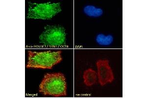 (ABIN571161) Immunofluorescence analysis of paraformaldehyde fixed Neuro-2a cells, permeabilized with 0.