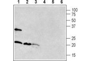 Western blot analysis of rat brain (lanes 1 and 4), mouse brain (lanes 2 and 5) and rat pancreas (lanes 3 and 6): - 1-3. (RAMP1 抗体  (Extracellular, N-Term))