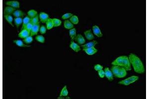 Immunofluorescent analysis of PC-3 cells using ABIN7154647 at dilution of 1:100 and Alexa Fluor 488-congugated AffiniPure Goat Anti-Rabbit IgG(H+L) (C9ORF72 抗体  (AA 138-430))