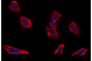 ABIN6264754 and ABIN6273309 staining Hela by IF/ICC. (RIC8B 抗体  (C-Term))