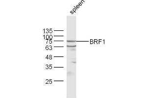 Mouse spleen lysates probed with Rabbit Anti-BRF1 Polyclonal Antibody, Unconjugated  at 1:500 for 90 min at 37˚C. (BRF1 抗体  (AA 501-600))