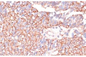 Immunohistochemistry (Paraffin-embedded Sections) (IHC (p)) image for anti-Acetyl-CoA Acetyltransferase 2 (ACAT2) antibody (ABIN7263895)