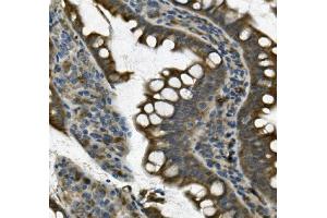 IHC analysis of UNG using anti UNG antibody (ABIN7602695). (UNG 抗体  (AA 96-313))