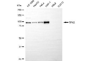 Western blotting analysis using TPX2 antibody (ABIN7800579). (Recombinant TPX2 抗体)