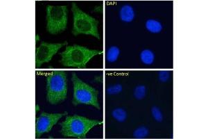 Immunofluoresence staining of fixed HeLa cells with anti-DC-SIGNR antibody 16E7. (Recombinant C-Type Lectin Domain Family 4, Member M (CLEC4M) 抗体)
