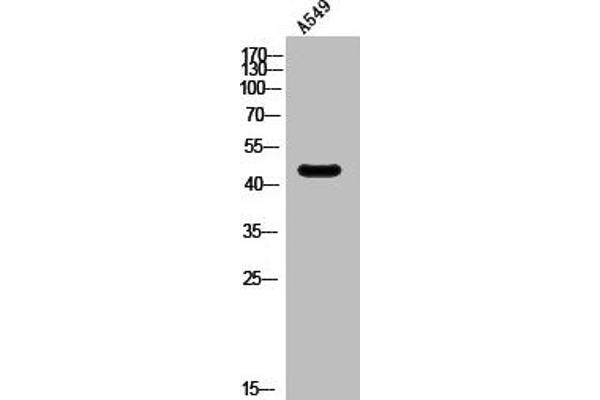 Serotonin Receptor 6 抗体  (Internal Region)