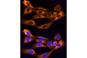 Immunofluorescence (IF) image for anti-Collagen, Type I, alpha 1 (COL1A1) (AA 100-200) antibody (ABIN6138837)