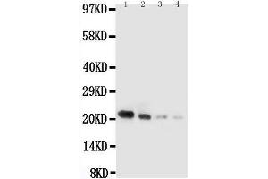 Anti-mouse IL18 antibody, Western blotting Lane 1: Recombinant Mouse IL18 Protein 10ng Lane 2: Recombinant Mouse IL18 Protein 5ng Lane 3: Recombinant Mouse IL18 Protein 2 (IL-18 抗体  (AA 36-192))
