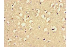 Immunohistochemistry of paraffin-embedded human brain tissue using ABIN7159790 at dilution of 1:100 (MAST1 抗体  (AA 687-879))