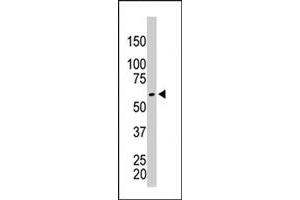 The PKM2 polyclonal antibody  is used in Western blot to detect PKM2 in HeLa cell lysate . (PKM2 抗体  (AA 483-513))