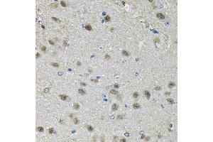 Immunohistochemistry of paraffin-embedded mouse brain using PPID Antibody (ABIN5974177) at dilution of 1/100 (40x lens). (PPID 抗体)
