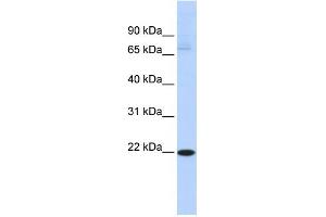 WB Suggested Anti-RBPMS2 Antibody Titration:  0. (RBPMS2 抗体  (Middle Region))