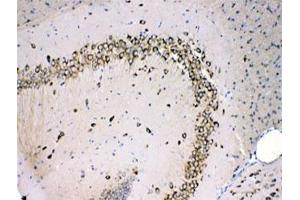 IHC testing of FFPE mouse brain with MPS1 antibody at 1ug/ml. (RPS27 抗体)