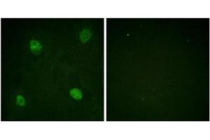 Immunofluorescence staining of methanol-fixed HeLa cells using hnRPD (Phospho-Ser83) Antibody. (HNRNPD/AUF1 抗体  (pSer83))