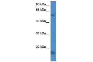 GPT2 antibody used at 1 ug/ml to detect target protein. (GPT2 抗体)
