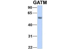 Western Blotting (WB) image for anti-Glycine Amidinotransferase (L-Arginine:glycine Amidinotransferase) (GATM) (Middle Region) antibody (ABIN2783416)