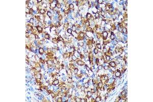 Immunohistochemistry of paraffin-embedded Rat ovary using [KO Validated] CHCHD2 Rabbit pAb (ABIN7266448) at dilution of 1:100 (40x lens). (CHCHD2 抗体  (AA 75-145))