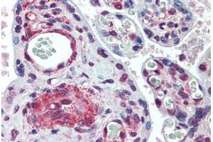 anti-Symplekin (SYMPK) (AA 1-534) antibody