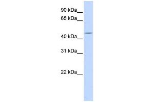 WB Suggested Anti-HSFY1 Antibody Titration:  0. (HSFY1 抗体  (Middle Region))
