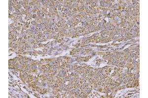 IHC analysis of CLASP1 using anti-CLASP1 antibody (ABIN7599144). (CLASP1 抗体  (AA 1-243))