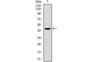 Western Blotting (WB) image for anti-Argininosuccinate Synthase 1 (ASS1) antibody (ABIN1105455) (ASS1 抗体)