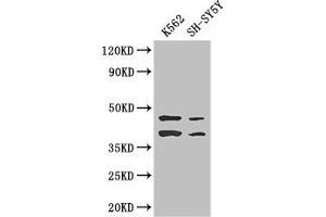 Western Blot Positive WB detected in: K562 whole cell lysate, SH-SY5Y whole cell lysate All lanes: AIM2 antibody at 2. (AIM2 抗体  (AA 81-326))