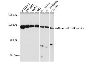 Western Blotting (WB) image for anti-Nuclear Receptor Subfamily 3, Group C, Member 1 (Glucocorticoid Receptor) (NR3C1) antibody (ABIN7269016)