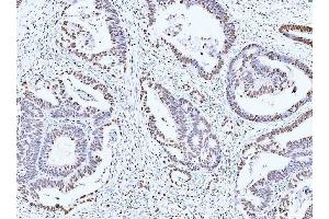 IHC analysis of MCM6 using anti-MCM6 antibody (ABIN7600037). (MCM6 抗体  (AA 14-821))