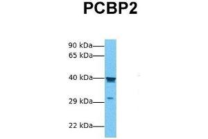 Western Blotting (WB) image for anti-Poly(rC) Binding Protein 2 (PCBP2) (Middle Region) antibody (ABIN2778923)