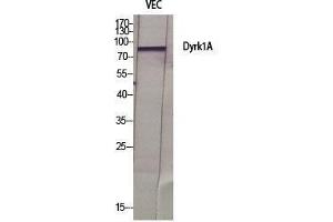 Western Blot (WB) analysis of specific cells using Dyrk1A Polyclonal Antibody. (DYRK1A 抗体  (N-Term))