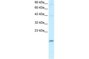 Western Blotting (WB) image for anti-Apolipoprotein B mRNA Editing Enzyme, Catalytic Polypeptide-Like 3G (APOBEC3G) antibody (ABIN2460746) (APOBEC3G 抗体)