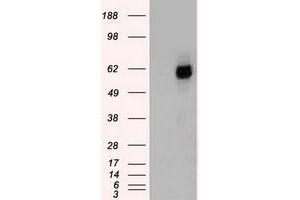 HEK293T cells were transfected with the pCMV6-ENTRY control (Left lane) or pCMV6-ENTRY CHEK2 (Right lane) cDNA for 48 hrs and lysed. (CHEK2 抗体)