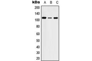 Western blot analysis of STK31 expression in HEK293T (A), SP2/0 (B), PC12 (C) whole cell lysates. (STK31 抗体  (Center))