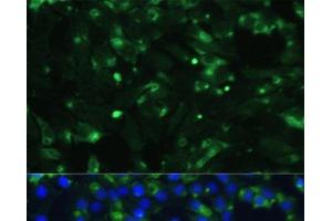 Immunofluorescence analysis of C6 cells using ENO1 Polyclonal Antibody at dilution of 1:100. (ENO1 抗体)