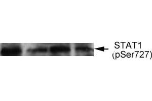 Western blot analysis of extract from thyroid cancer cell line Bph cells, using STAT1 (phospho-Ser727) antibody (E011163). (STAT1 抗体  (pSer727))