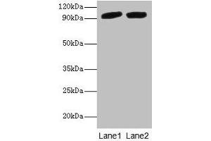 Western blot All lanes: POSTN antibody at 2 μg/mL Lane 1: Mouse liver tissue Lane 2: Hela whole cell lysate Secondary Goat polyclonal to rabbit IgG at 1/10000 dilution Predicted band size: 94, 88, 84, 91, 81 kDa Observed band size: 94 kDa