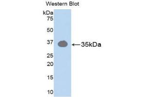 Western blot analysis of the recombinant protein. (Pkc beta 1 抗体  (AA 342-600))