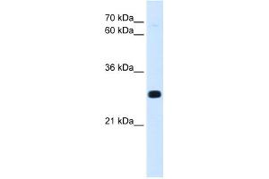 WB Suggested Anti-Antp Antibody Titration:  0. (HOXA7 抗体  (C-Term))