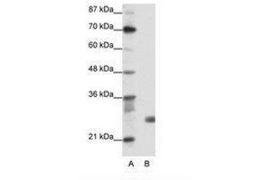 Image no. 1 for anti-Sin3A-Associated Protein, 30kDa (SAP30) (N-Term) antibody (ABIN202078) (SAP30 抗体  (N-Term))
