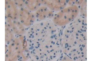 Detection of OPN in Rat Kidney Tissue using Polyclonal Antibody to Osteopontin (OPN) (Osteopontin 抗体  (AA 17-317))