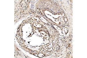 IHC analysis of HMGCS2 using anti-HMGCS2 antibody (ABIN7599435).