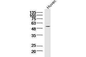 Lane 1: Huvec lysates probed with TNFAIP5 Polyclonal Antibody, Unconjugated  at 1:300 overnight at 4˚C. (PTX3 抗体  (AA 151-250))