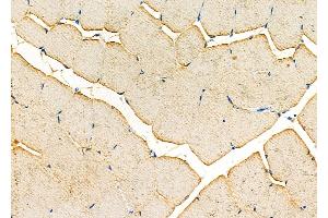 ABIN6256821 and ABIN6277223 at 1/100 staining Rat muscle tissue by IHC-P. (Choline Acetyltransferase 抗体  (C-Term))