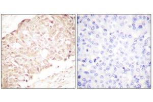 Immunohistochemistry (IHC) image for anti-SUMO1/sentrin Specific Peptidase 1 (SENP1) (N-Term) antibody (ABIN1848840) (SENP1 抗体  (N-Term))