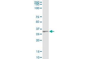 Immunoprecipitation of TRIM72 transfected lysate using anti-TRIM72 MaxPab rabbit polyclonal antibody and Protein A Magnetic Bead , and immunoblotted with TRIM72 purified MaxPab mouse polyclonal antibody (B01P) . (TRIM72 抗体  (AA 1-269))