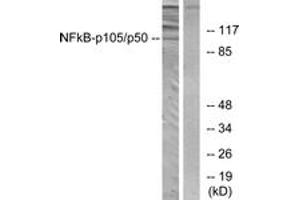 Western blot analysis of extracts from HeLa cells, using NF-kappaB p105/p50 (Ab-893) Antibody. (NFKB1 抗体  (AA 860-909))