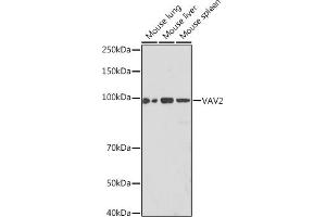 Western blot analysis of extracts of various cell lines, using V Rabbit mAb (ABIN7271304) at 1:1000 dilution. (VAV2 抗体)